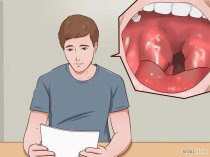 Imagem intitulada Evaluate and Treat Strep Throat Step 1