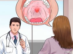 Imagem intitulada Get over Strep Throat Quickly Step 2