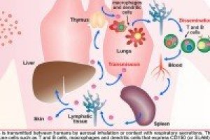 Component measles virus IgG EIA your value positive